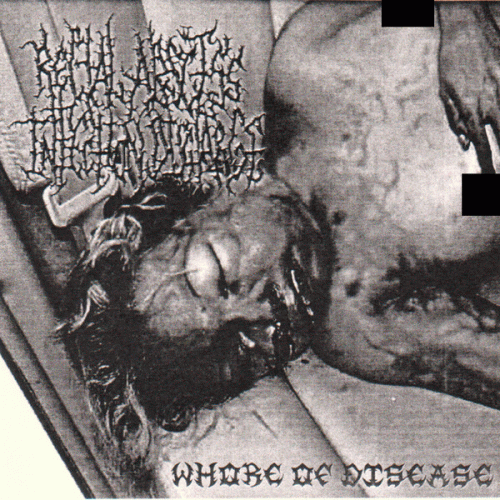 Rectal Abscess Infection Discharge : Whore of Disease